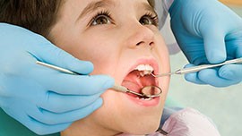 روش شیار بندی دندان با فیشورسیلانت چیست؟هزینه، مزایا و عوارض